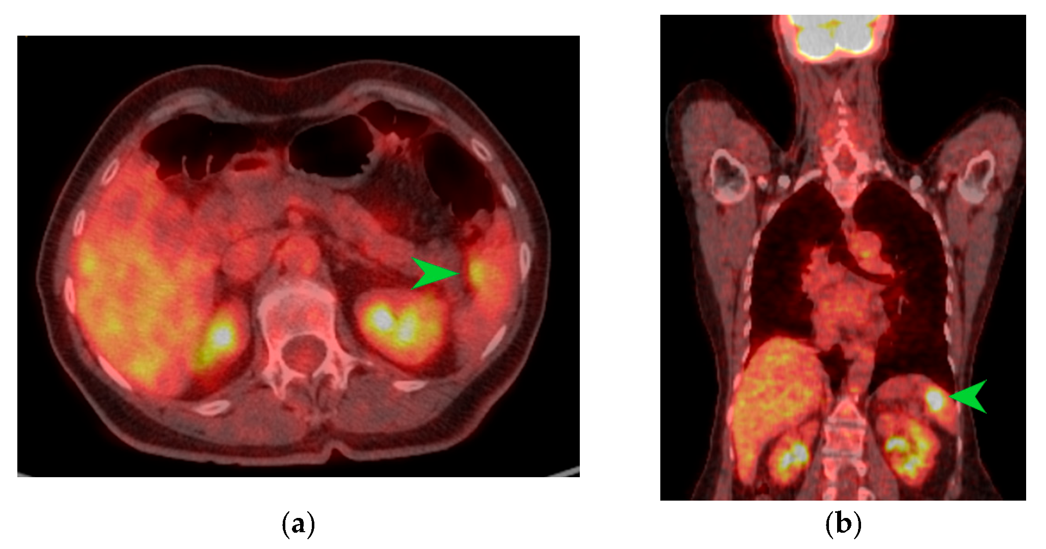 Diagnostics 15 02570 g003