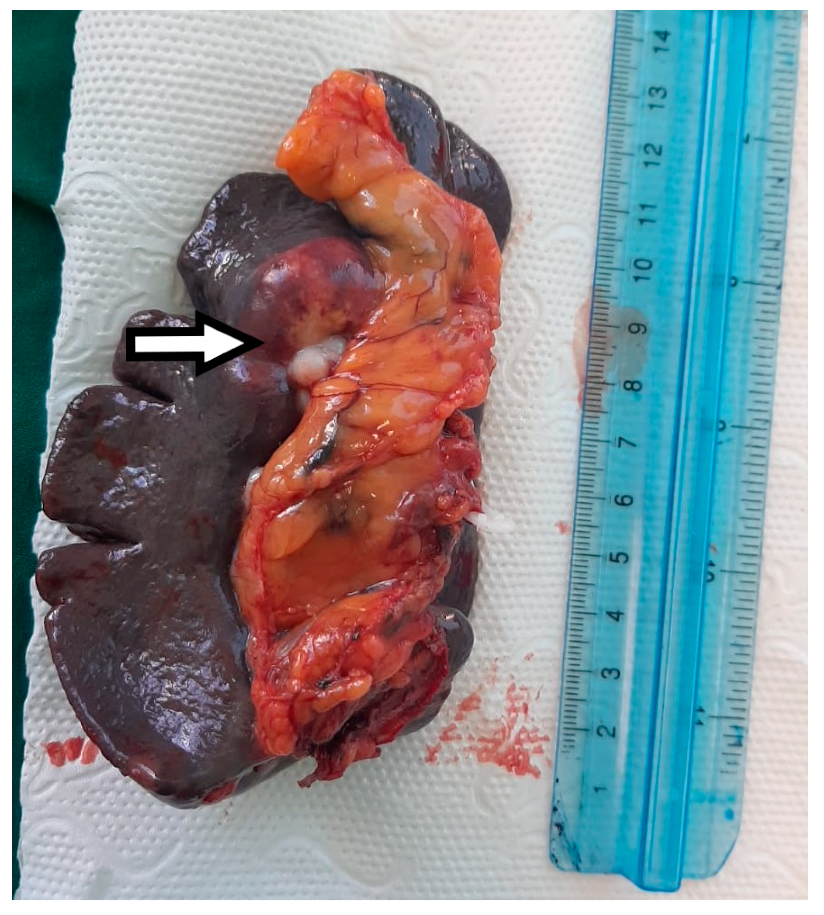 Diagnostics 15 02570 g005