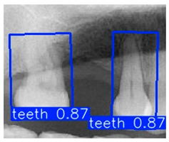Diagnostics 15 02598 i003