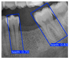 Diagnostics 15 02598 i005