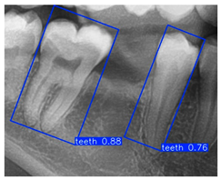 Diagnostics 15 02598 i006