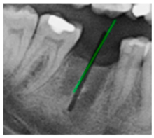 Diagnostics 15 02598 i013