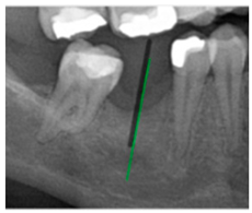 Diagnostics 15 02598 i014