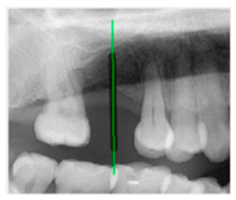 Diagnostics 15 02598 i015