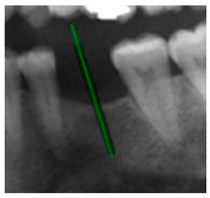 Diagnostics 15 02598 i016