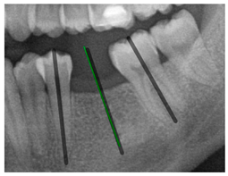 Diagnostics 15 02598 i017