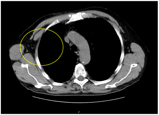 Diagnostics 15 02623 g007