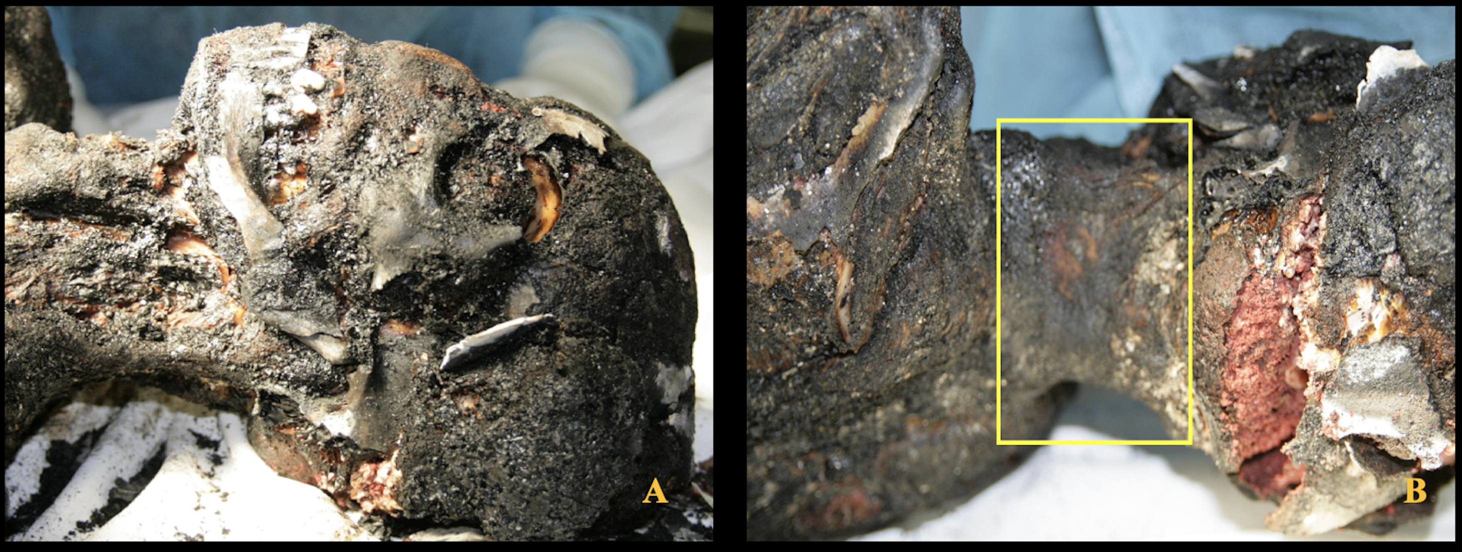 Diagnostics 15 02664 g002