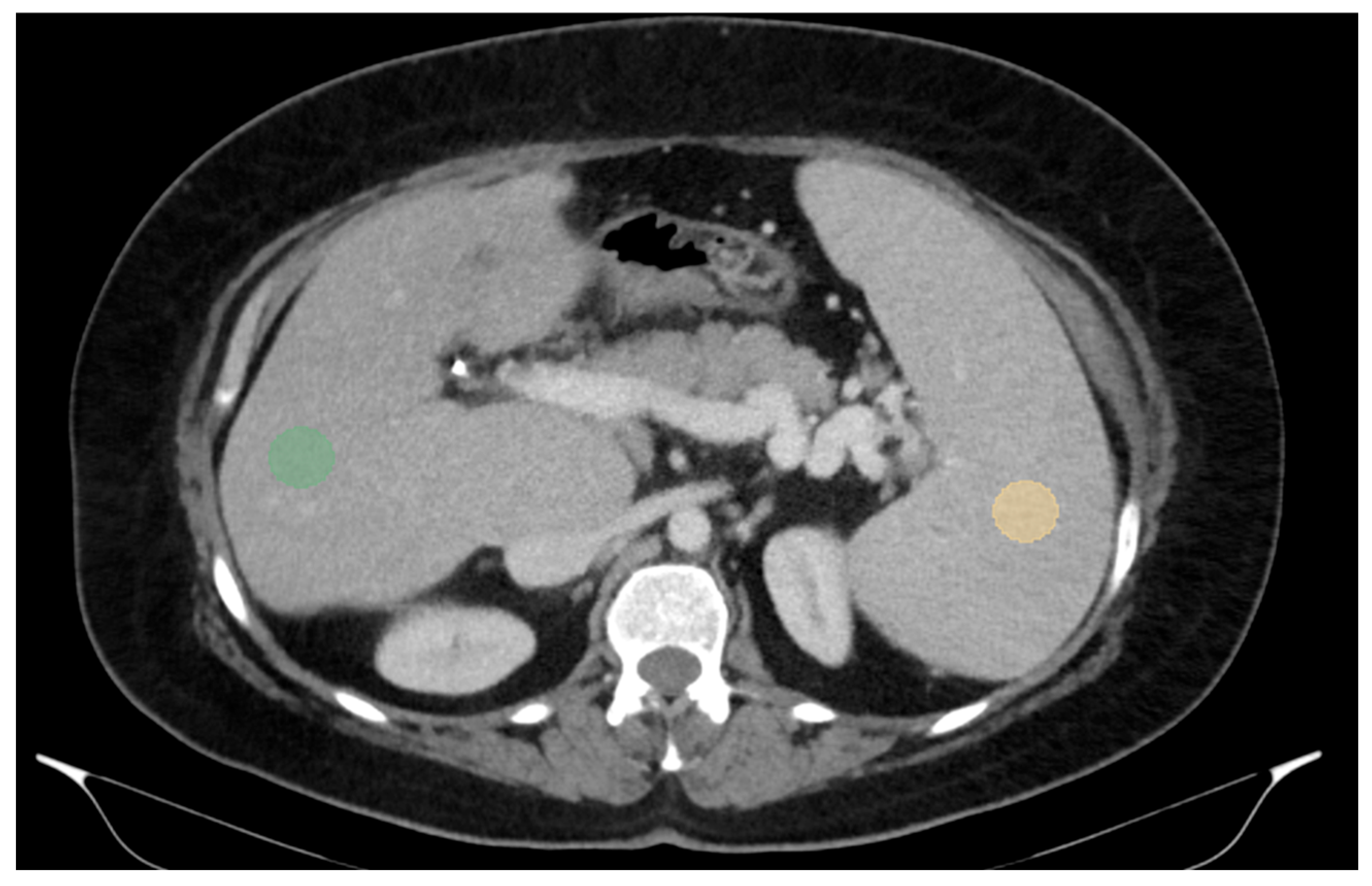 Diagnostics 15 02671 g001 Diagnostics 15 02671 g001