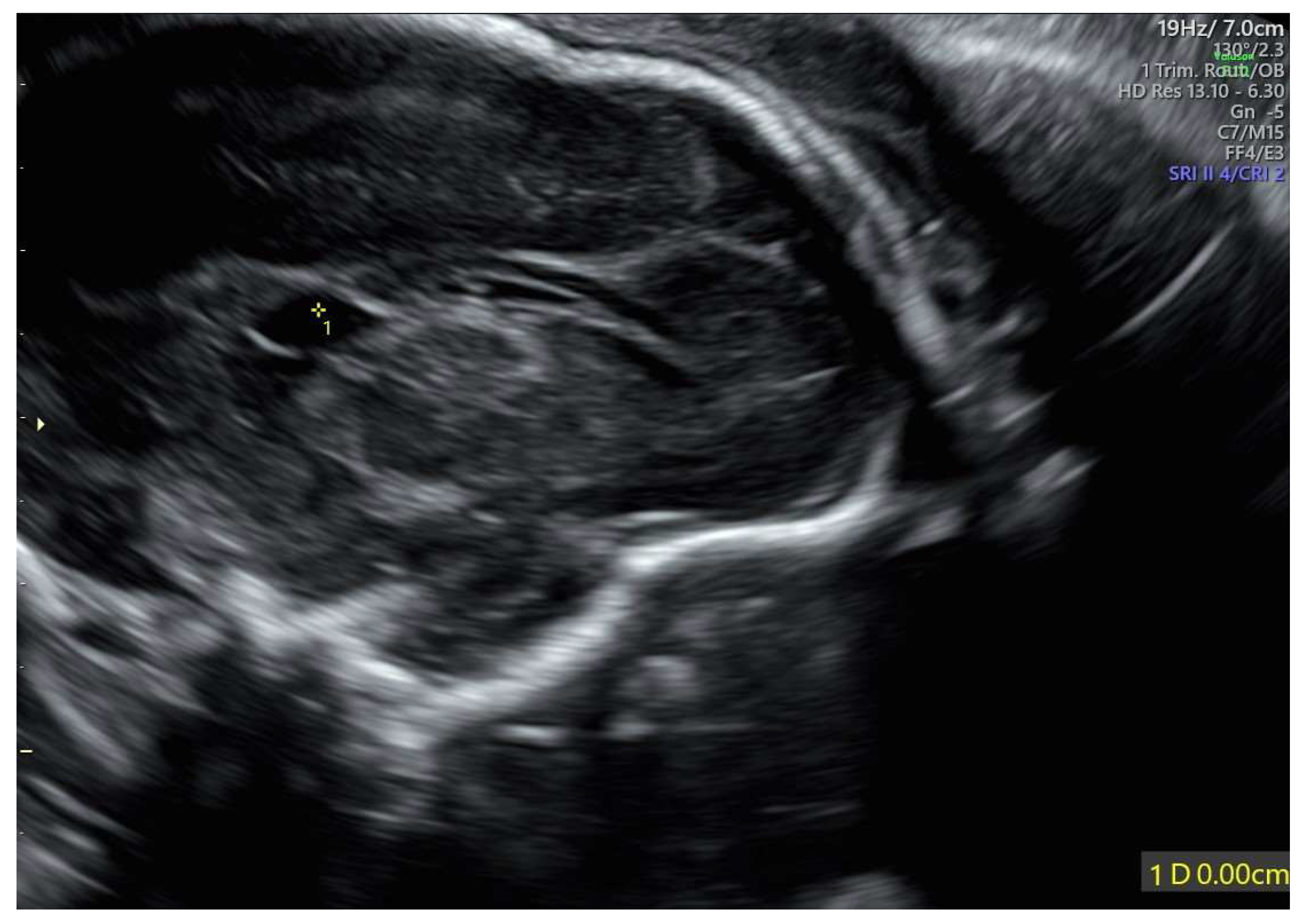 Diagnostics 15 02687 g002 Diagnostics 15 02687 g002