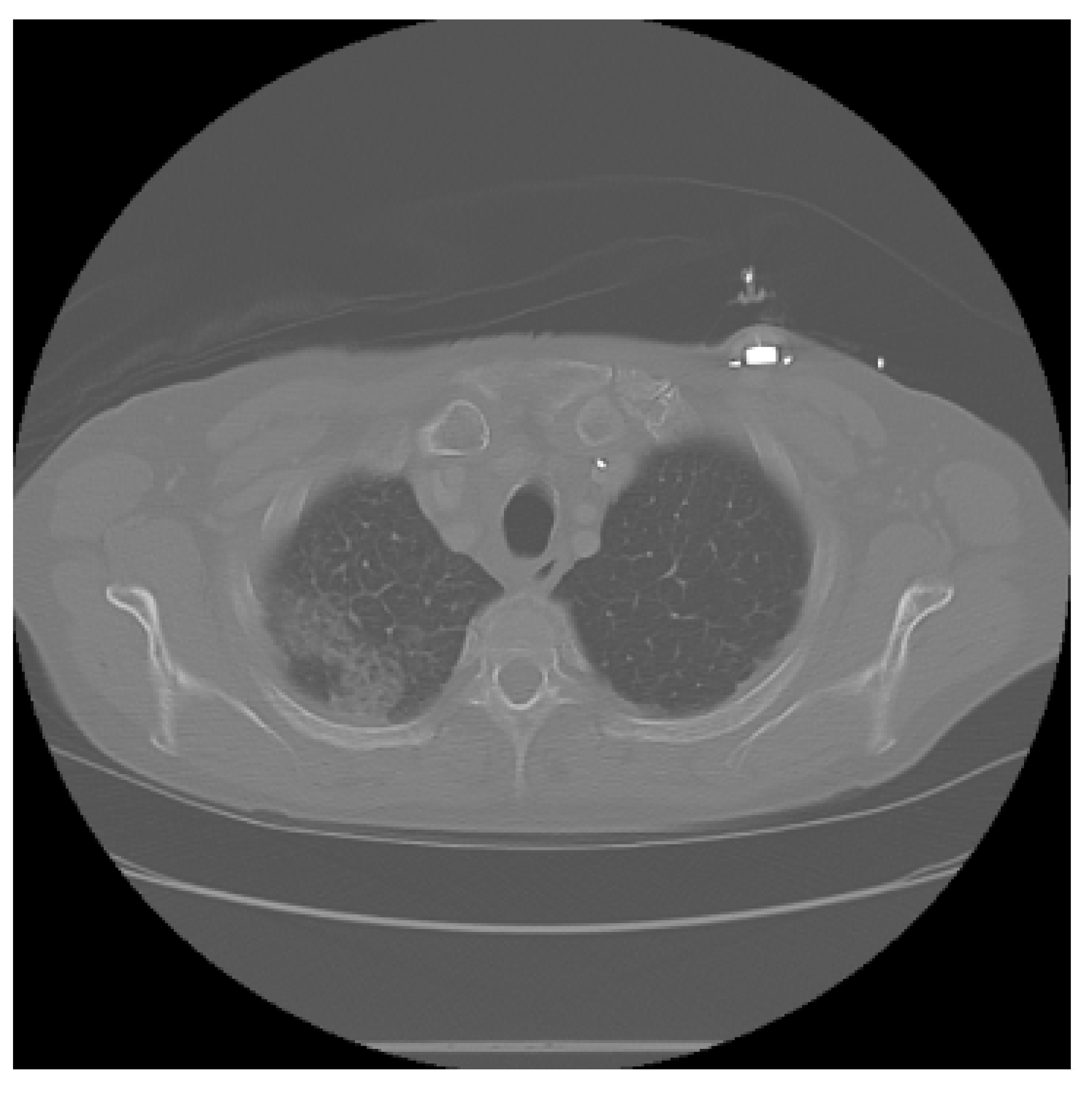 Diagnostics 15 02691 i002