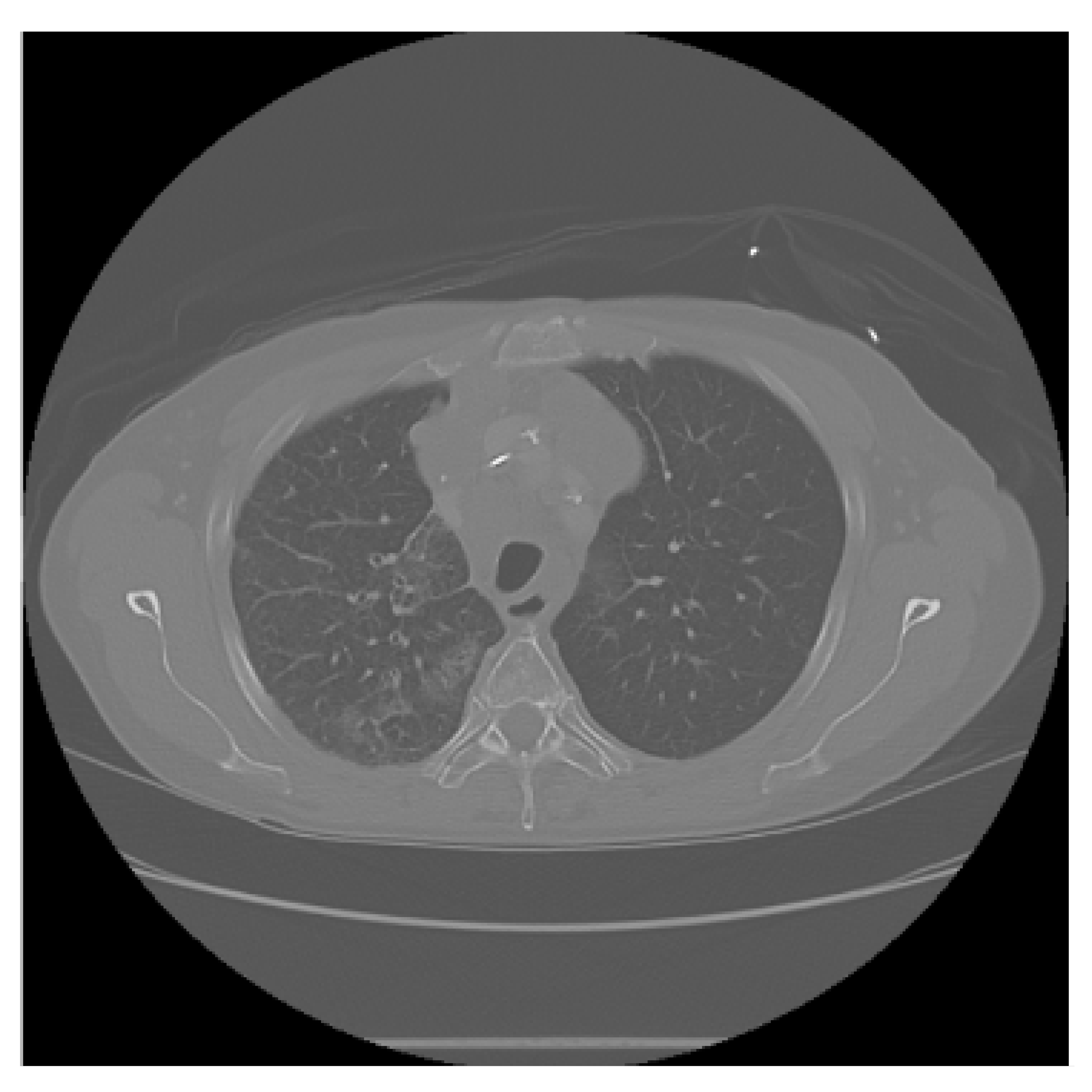 Diagnostics 15 02691 i004