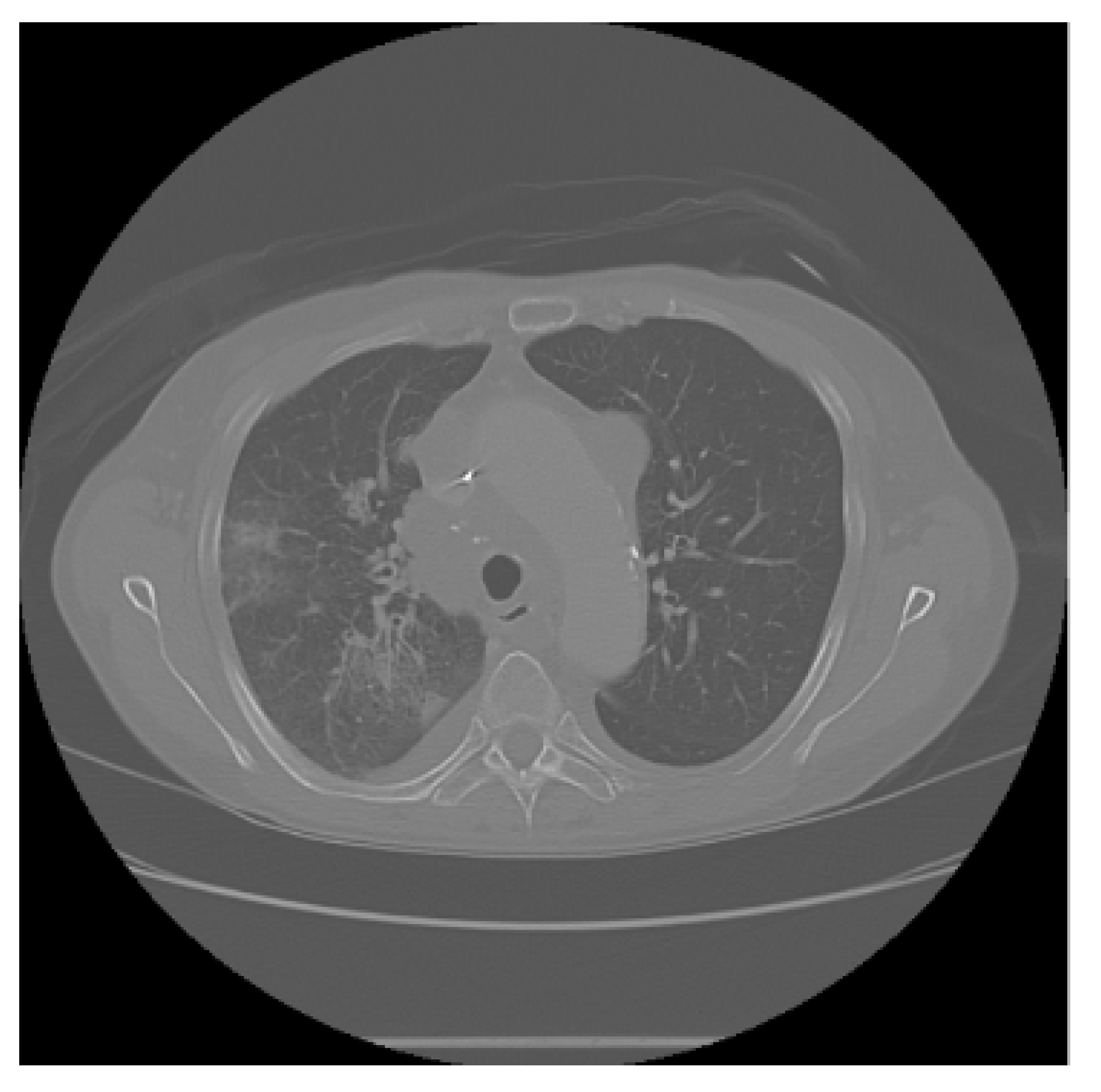 Diagnostics 15 02691 i006