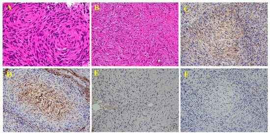 Diagnostics 15 02697 g005