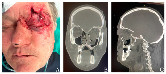 Diagnostics 15 02705 g001