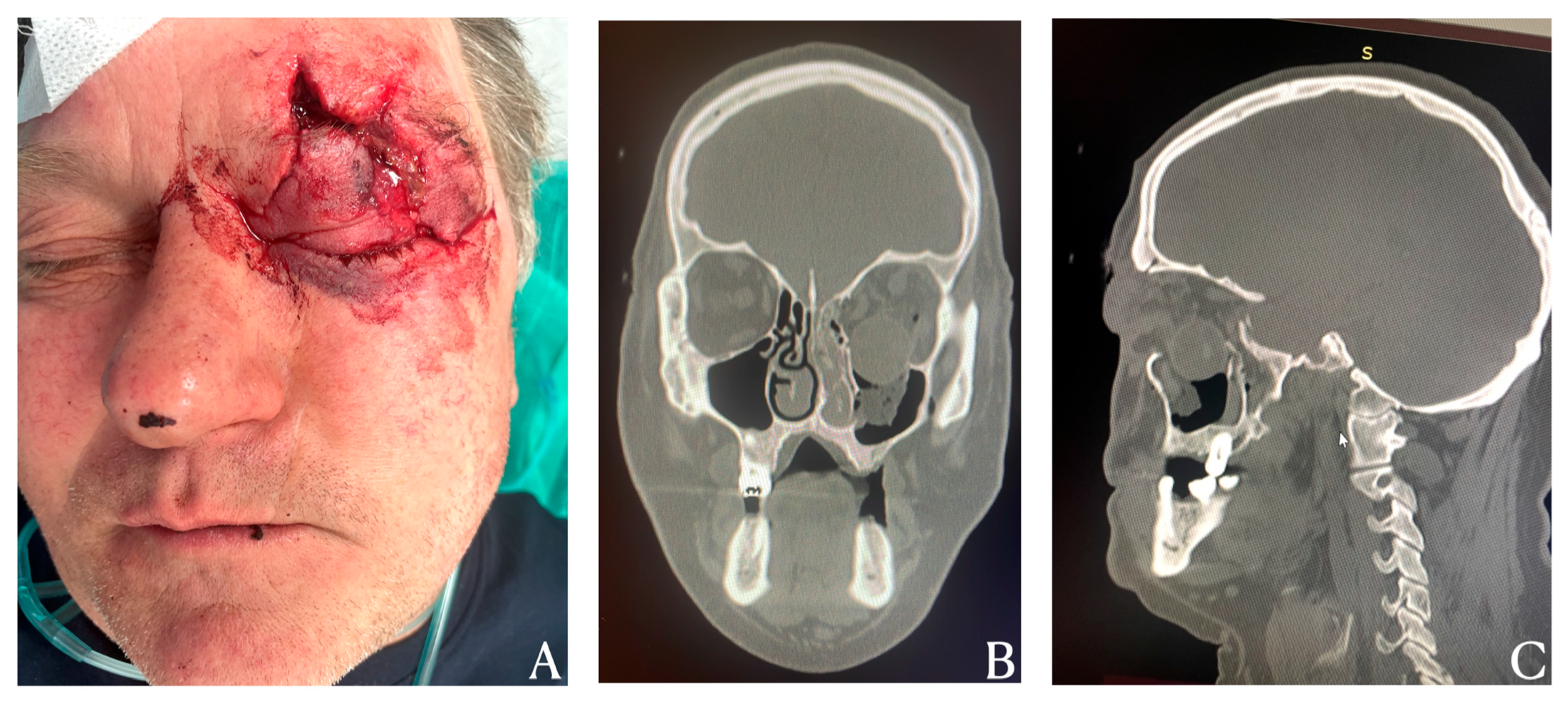 Diagnostics 15 02705 g001
