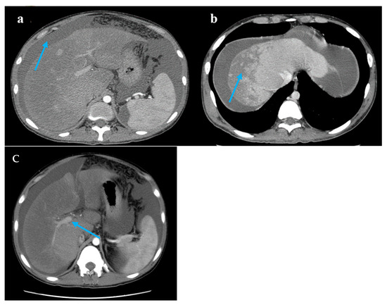 Diagnostics 15 02712 g001