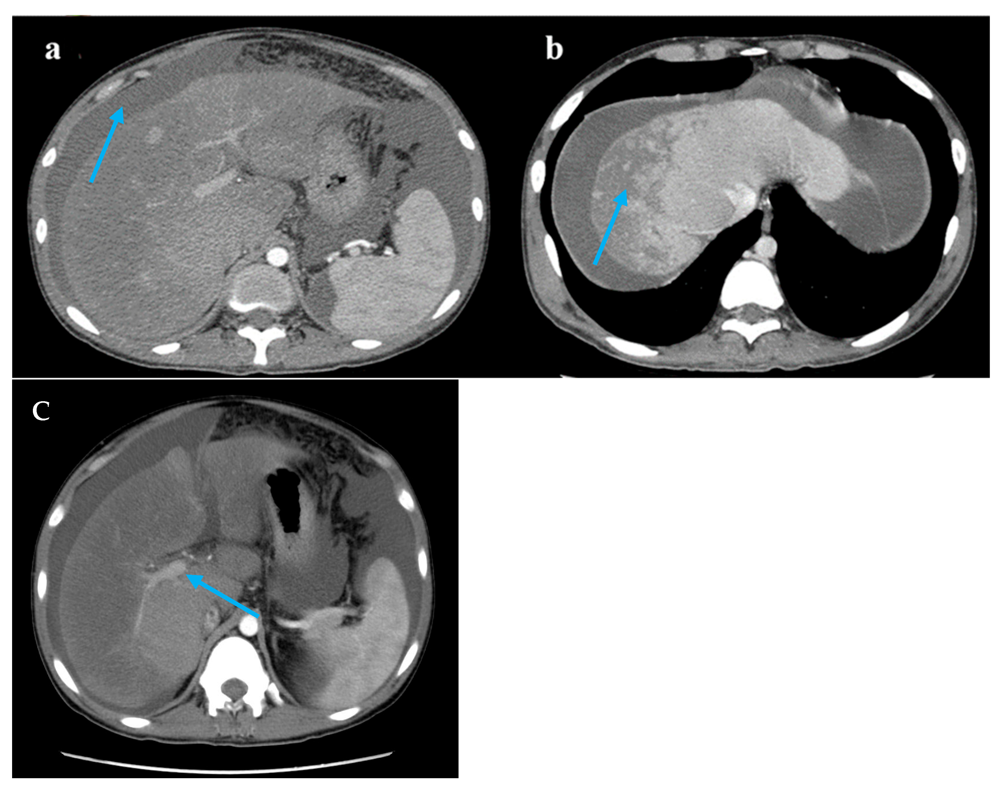 Diagnostics 15 02712 g001 Diagnostics 15 02712 g001