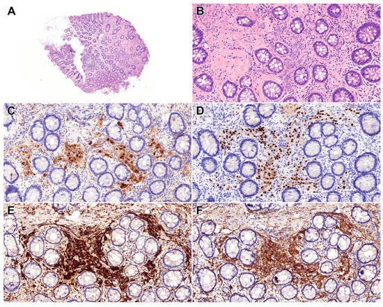 Diagnostics 15 02716 g001