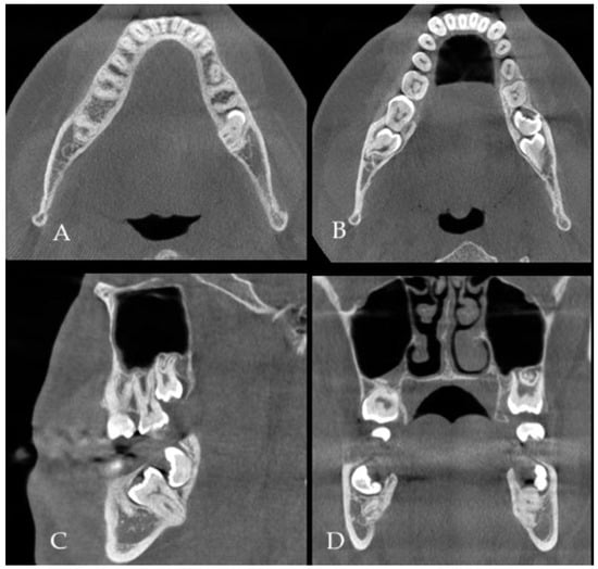 Diagnostics 15 02724 g001