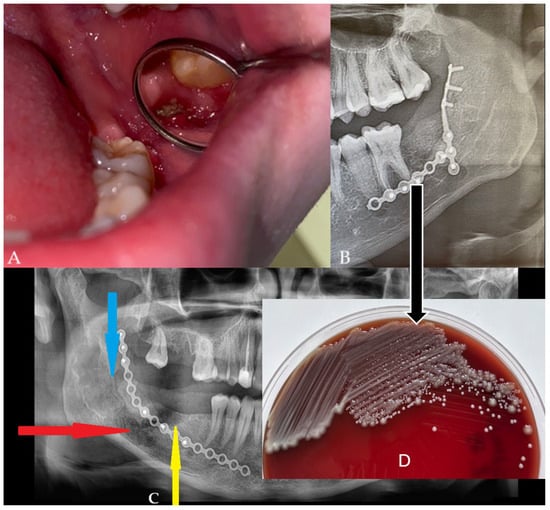Diagnostics 15 02724 g003