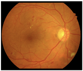 Diagnostics 15 02762 i004 Diagnostics 15 02762 i004