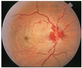 Diagnostics 15 02762 i005 Diagnostics 15 02762 i005