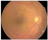 Diagnostics 15 02762 i006 Diagnostics 15 02762 i006