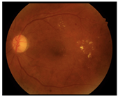 Diagnostics 15 02762 i007 Diagnostics 15 02762 i007