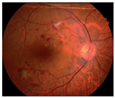 Diagnostics 15 02762 i012 Diagnostics 15 02762 i012