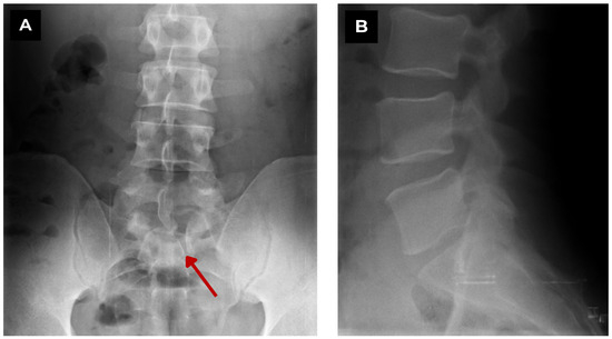 Diagnostics 15 02775 g001
