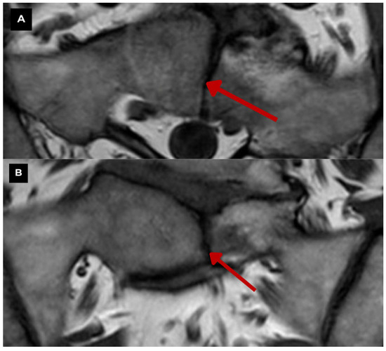 Diagnostics 15 02775 g006a