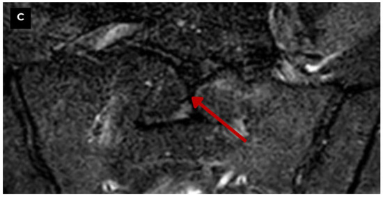 Diagnostics 15 02775 g006b