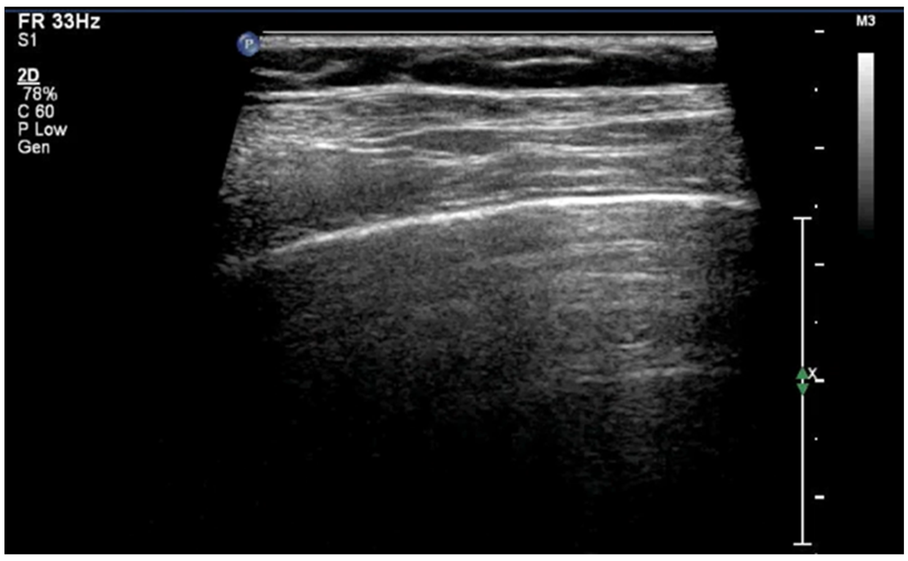 Diagnostics 15 02782 g005 Diagnostics 15 02782 g005