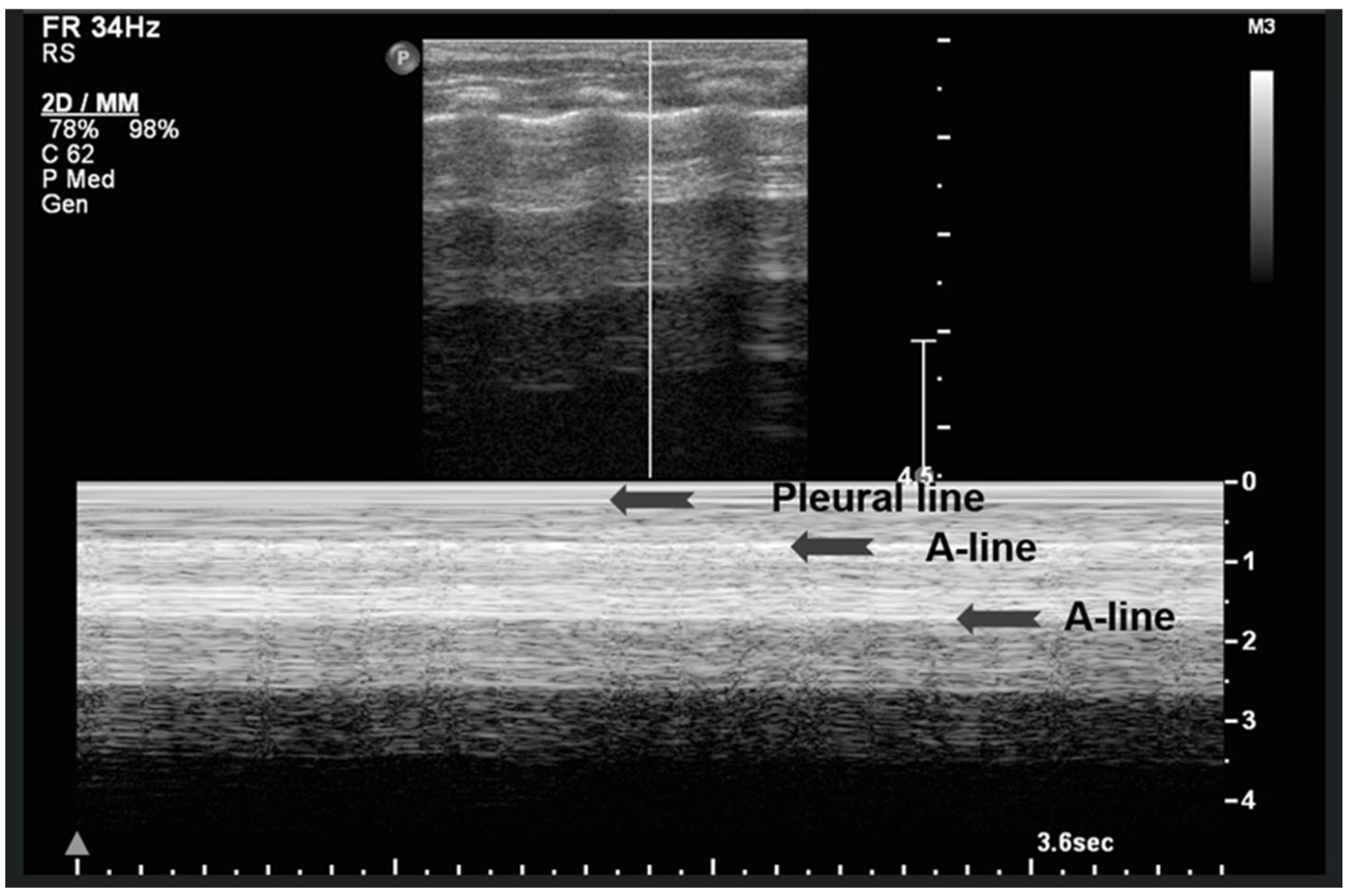 Diagnostics 15 02782 g006 Diagnostics 15 02782 g006