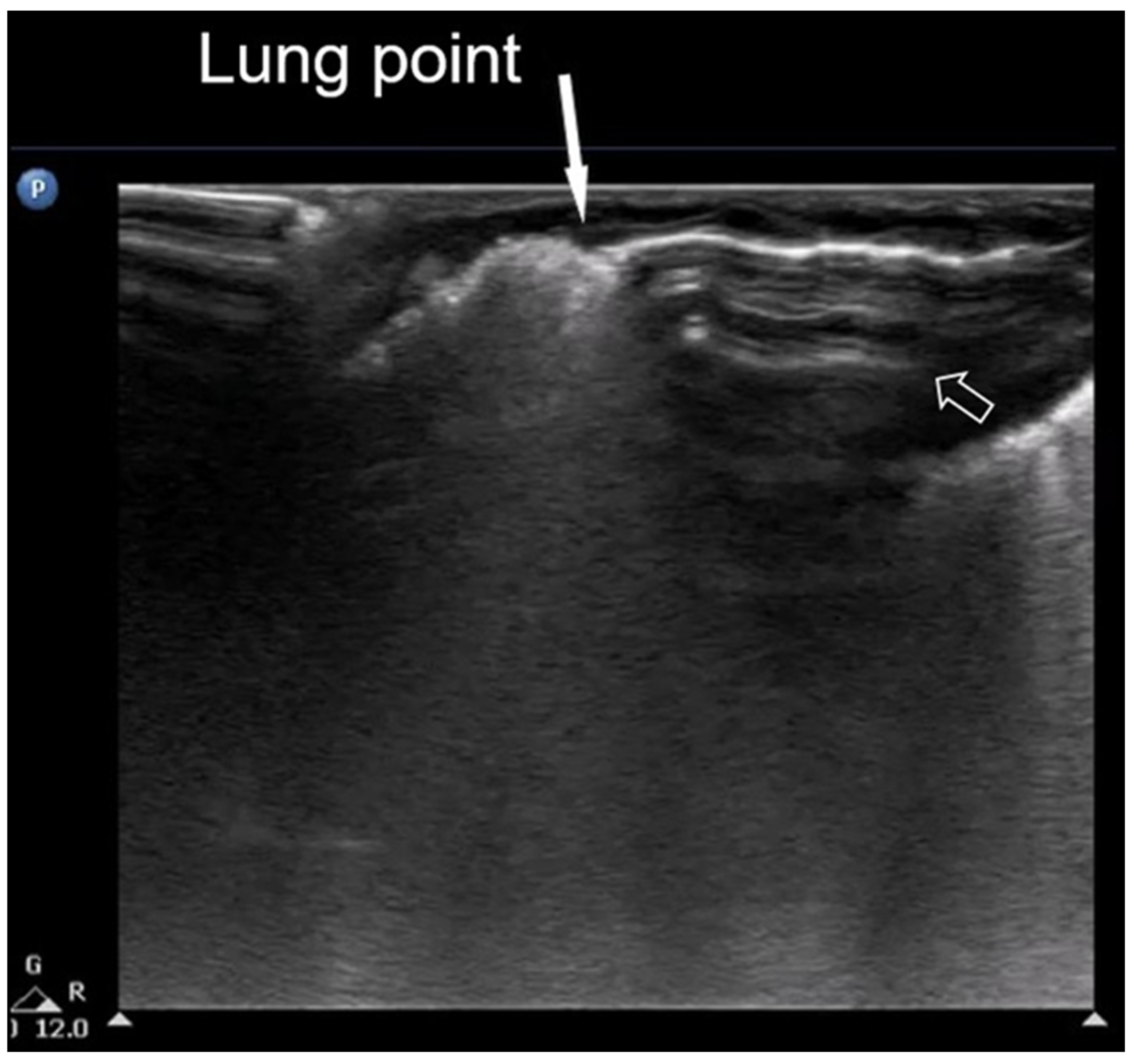 Diagnostics 15 02782 g008 Diagnostics 15 02782 g008