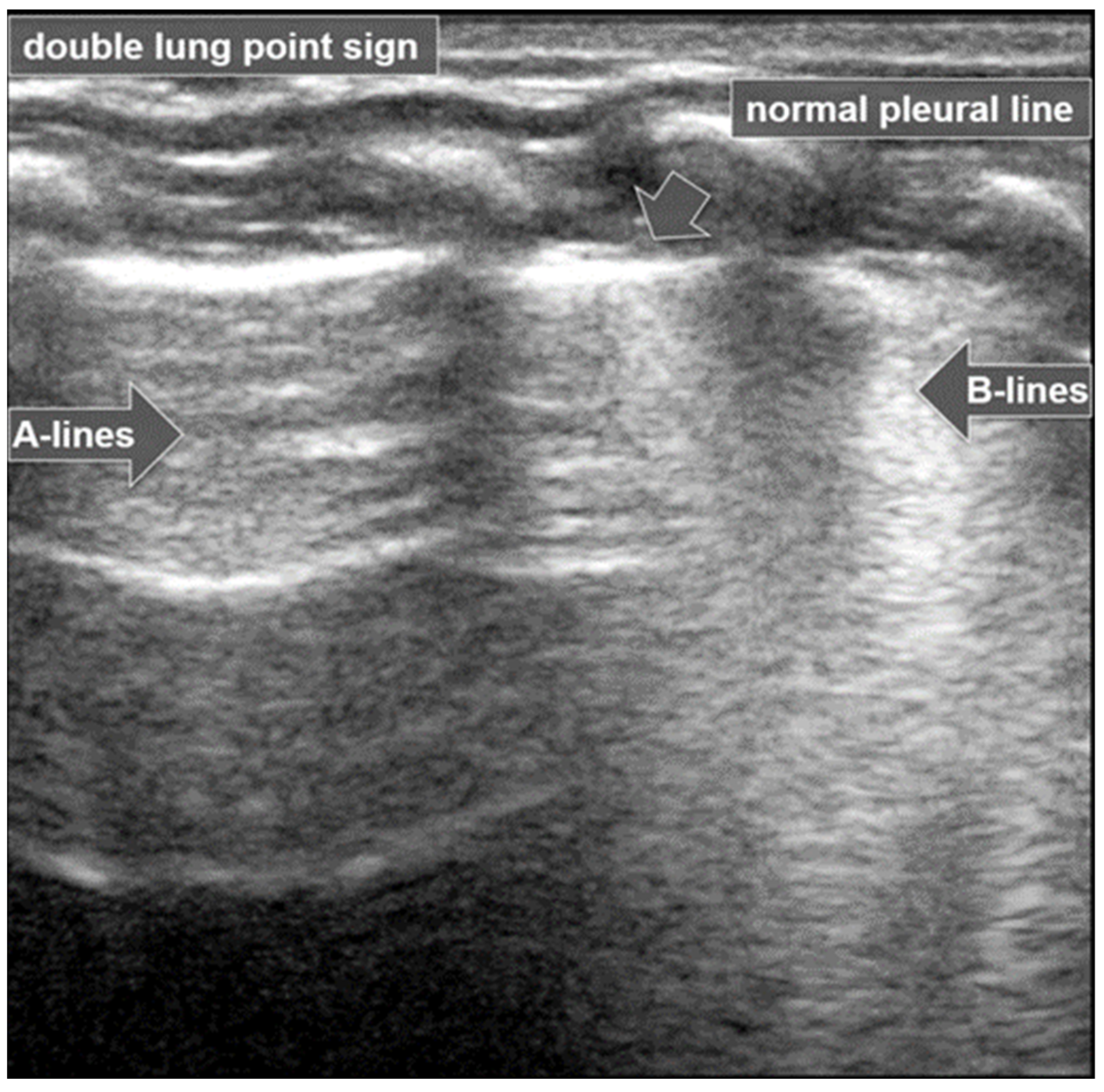 Diagnostics 15 02782 g011 Diagnostics 15 02782 g011