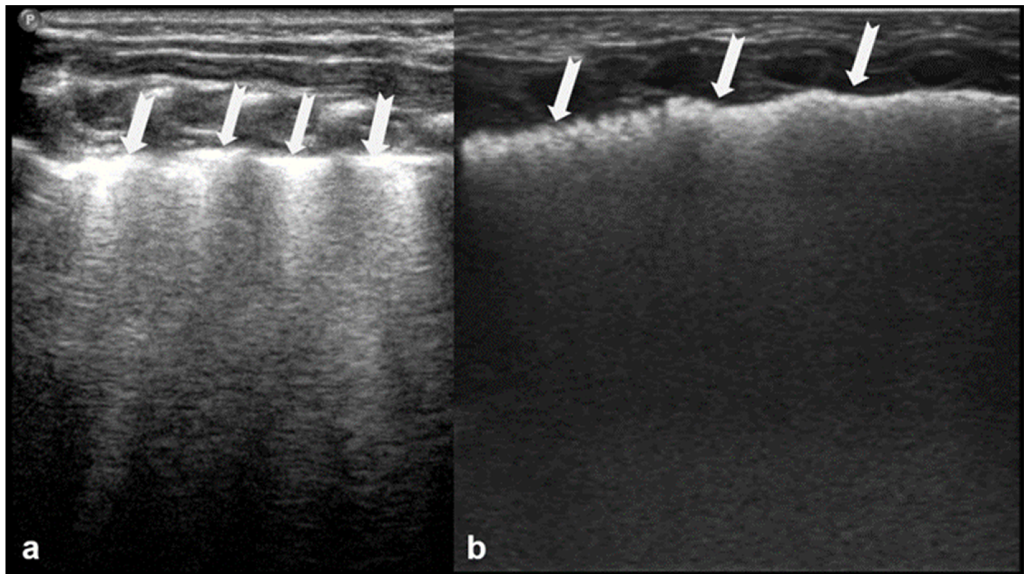 Diagnostics 15 02782 g012 Diagnostics 15 02782 g012