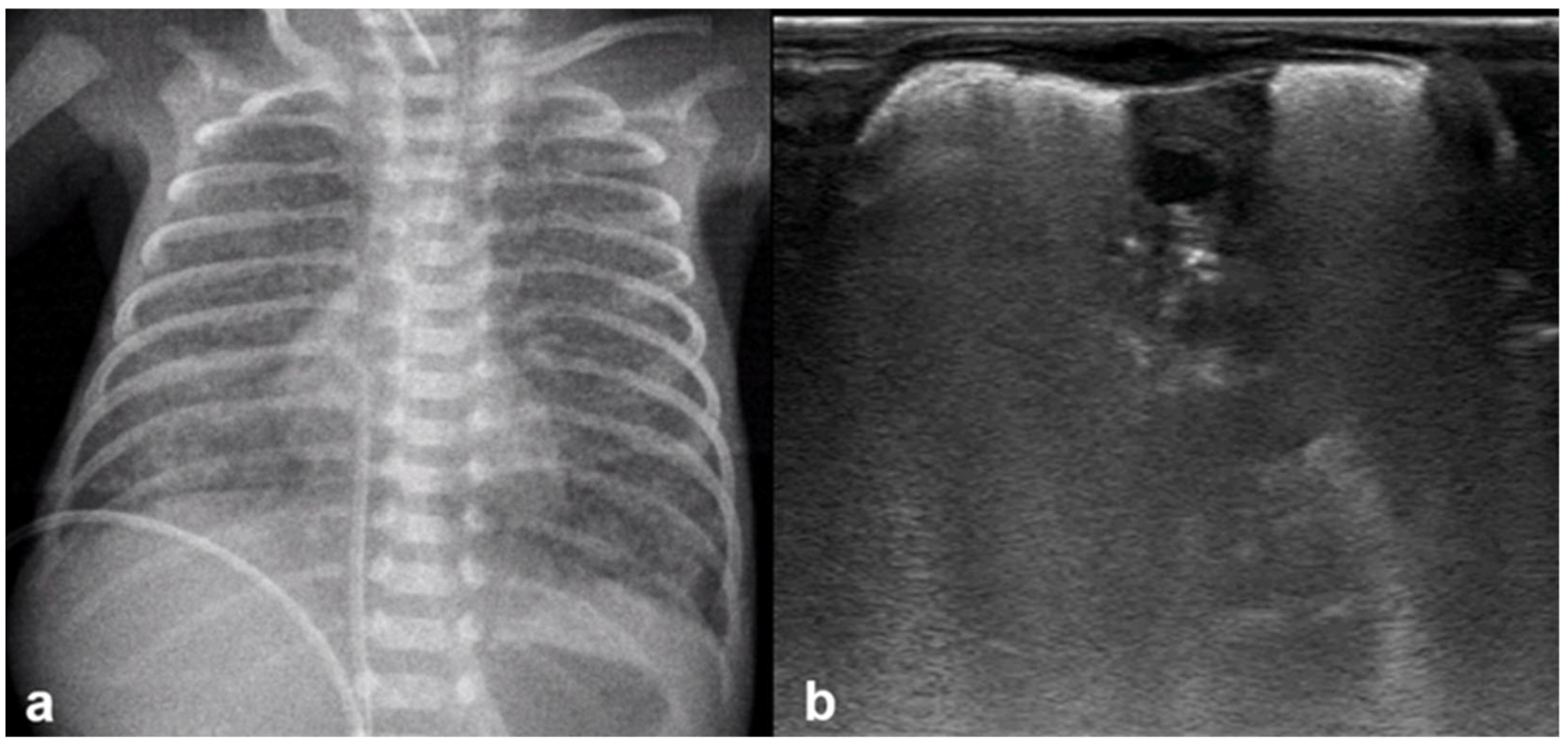 Diagnostics 15 02782 g016 Diagnostics 15 02782 g016