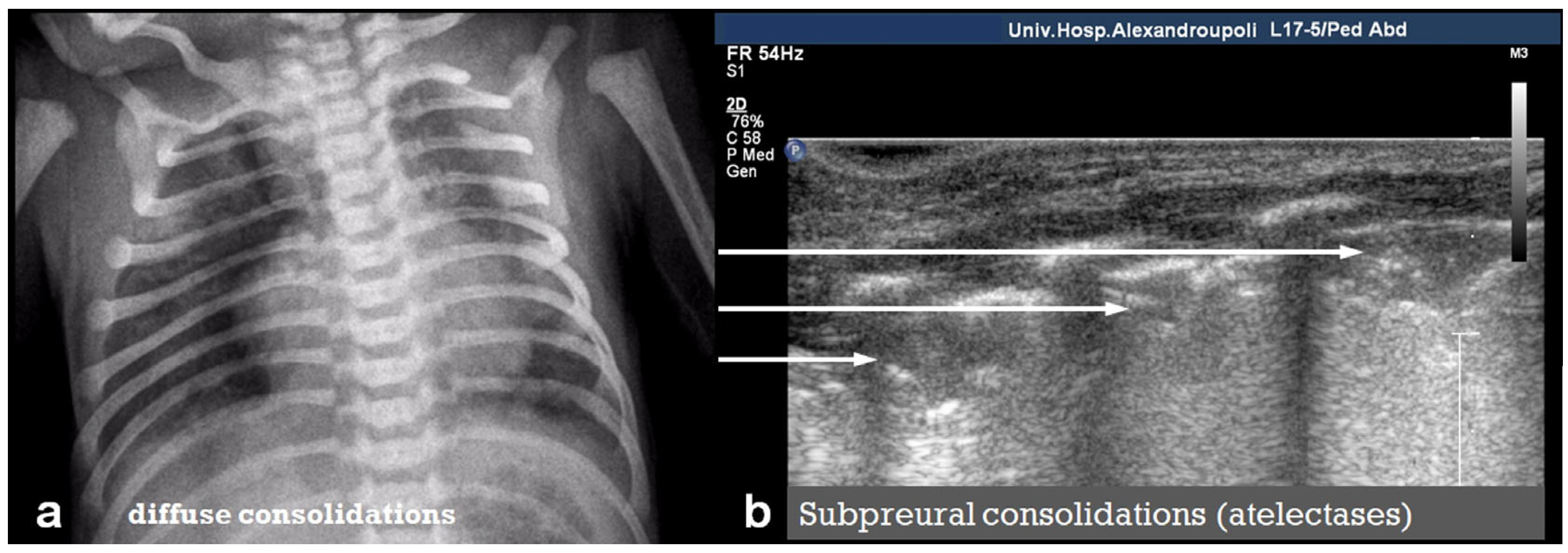 Diagnostics 15 02782 g017 Diagnostics 15 02782 g017