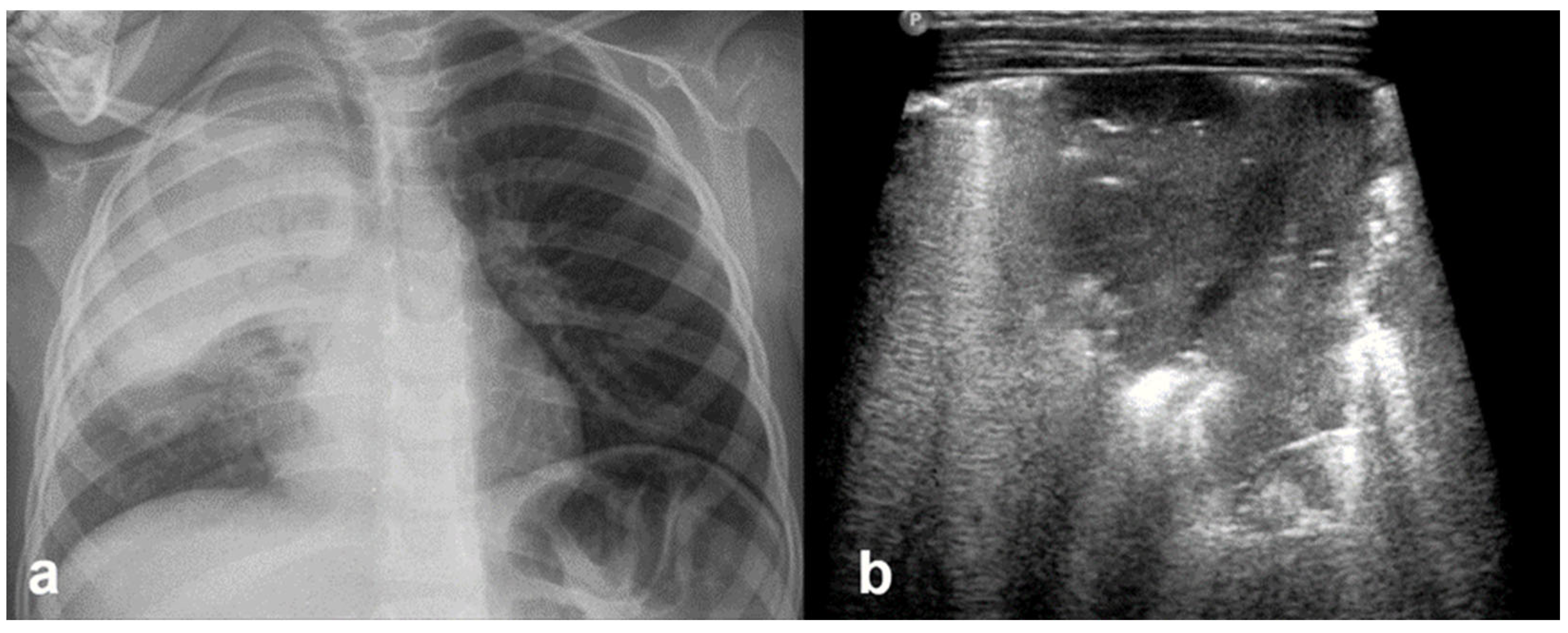 Diagnostics 15 02782 g021 Diagnostics 15 02782 g021