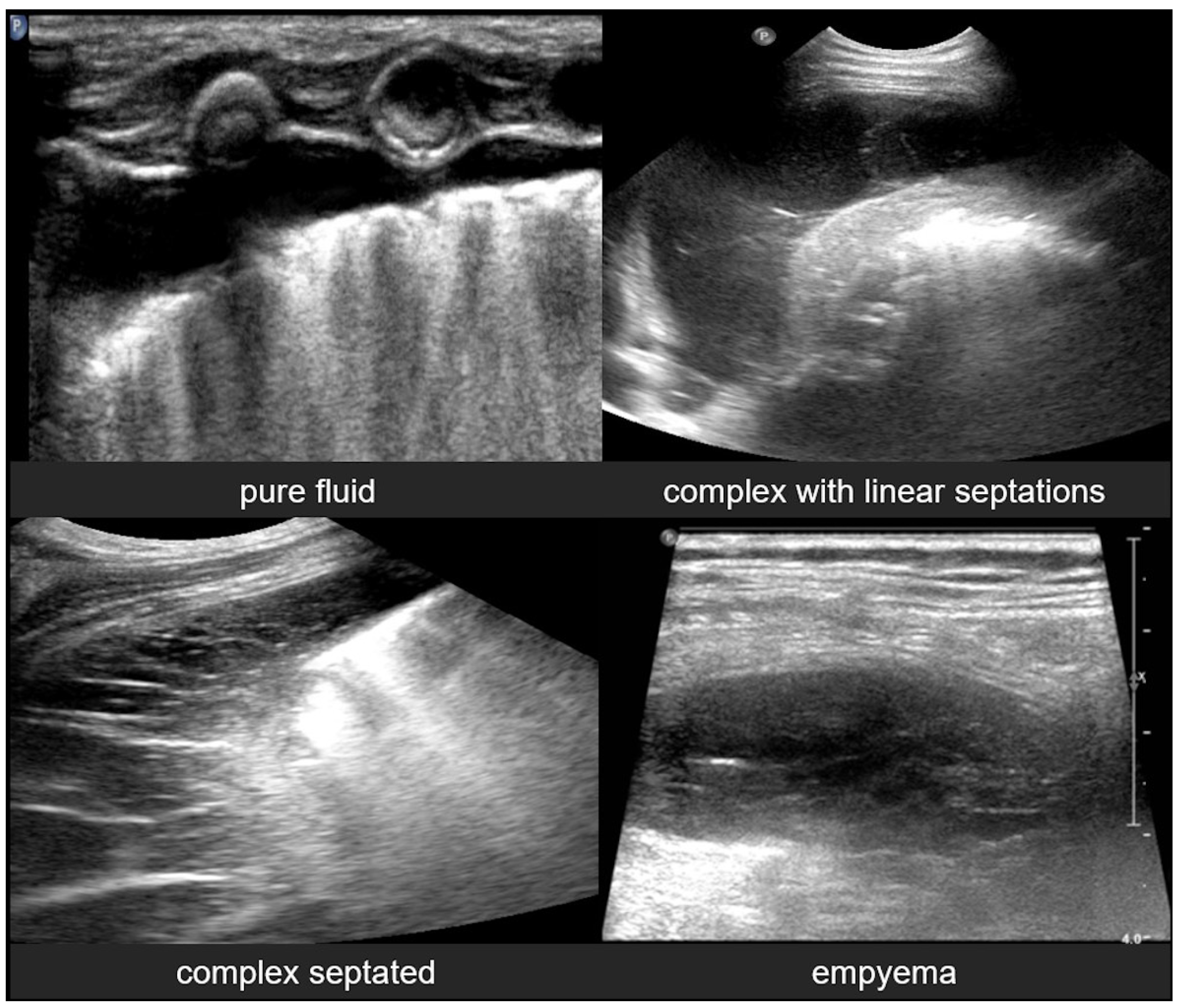 Diagnostics 15 02782 g023 Diagnostics 15 02782 g023