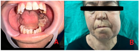 Diagnostics 15 02798 g001