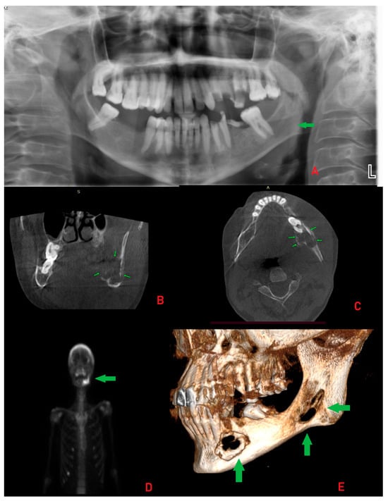 Diagnostics 15 02798 g002