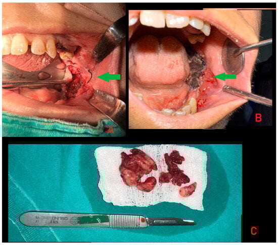 Diagnostics 15 02798 g003