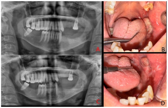 Diagnostics 15 02798 g005