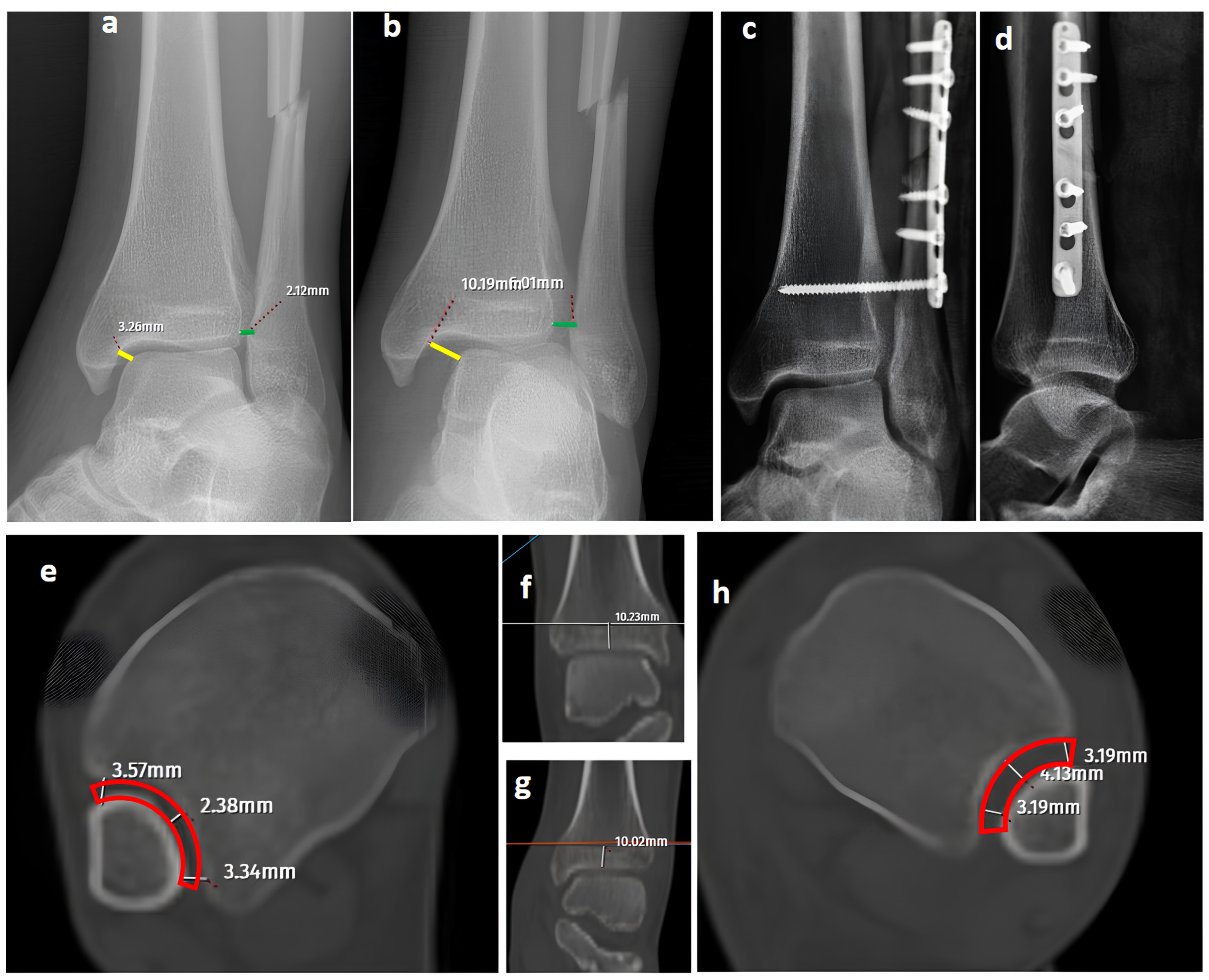 Diagnostics 15 02803 g003