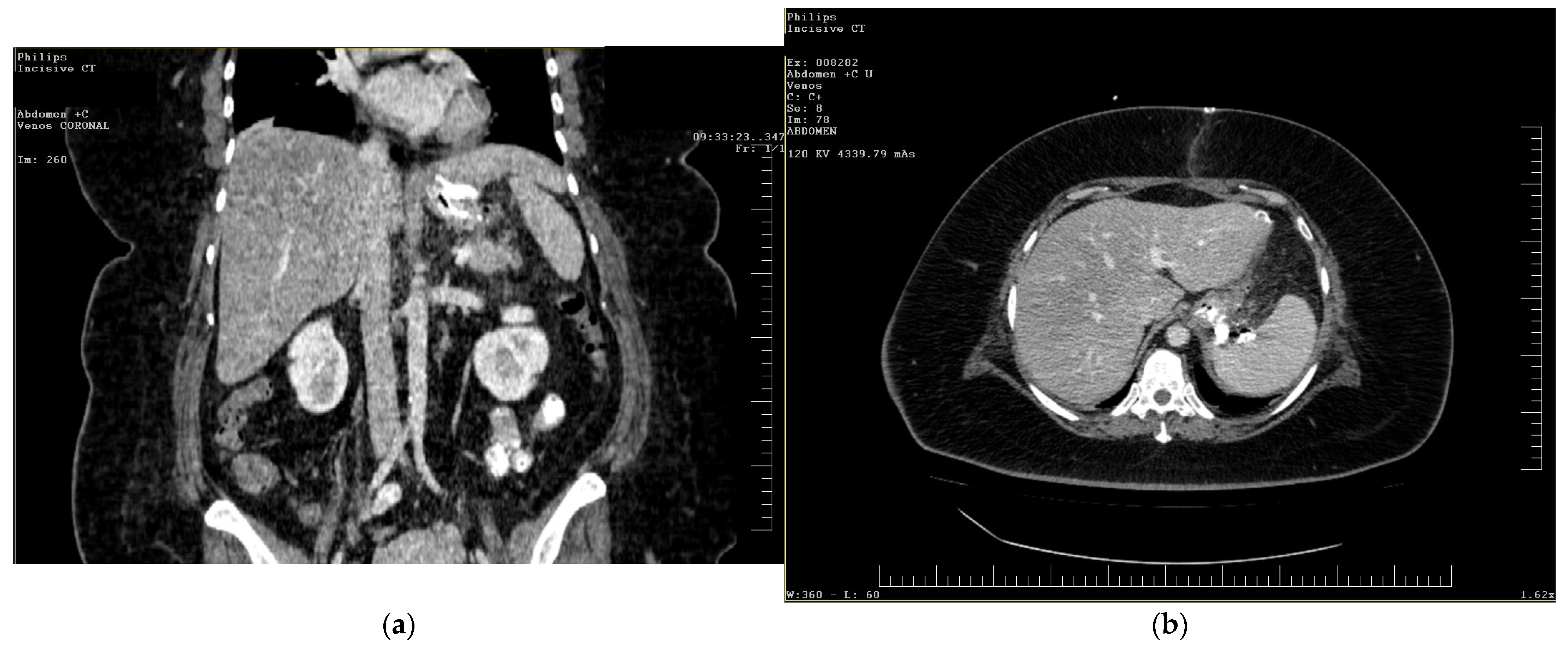 Diagnostics 15 02811 g001