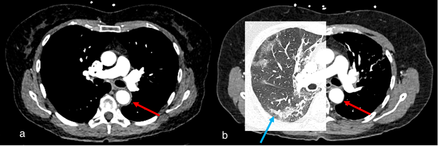 Diagnostics 15 02832 g004