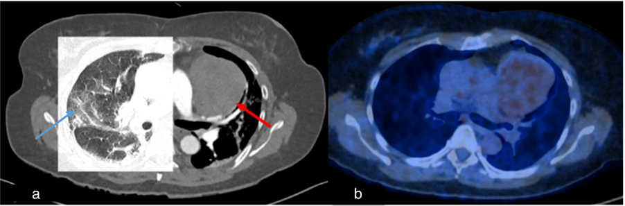 Diagnostics 15 02832 g005